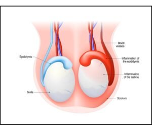 testicular detail image