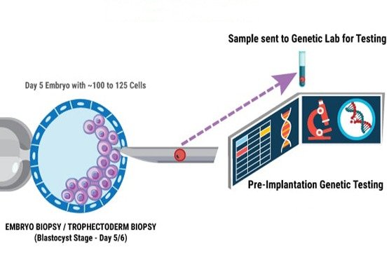 Embryo Biopsy procedure