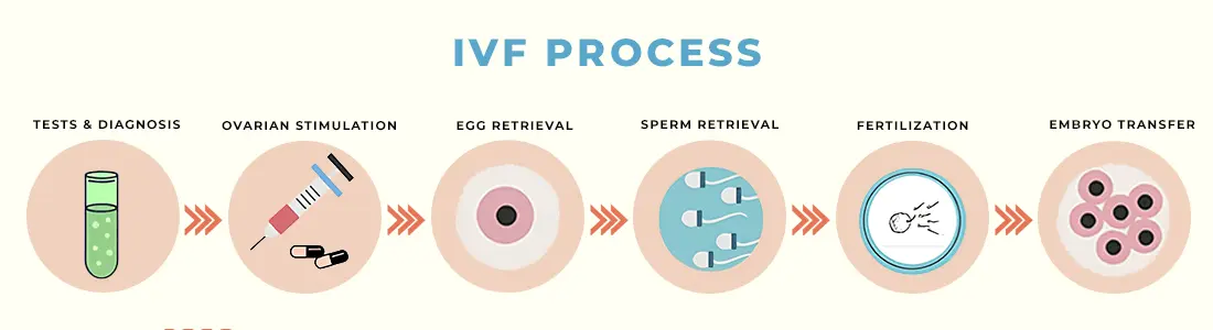 Process & Procedures (IVF)