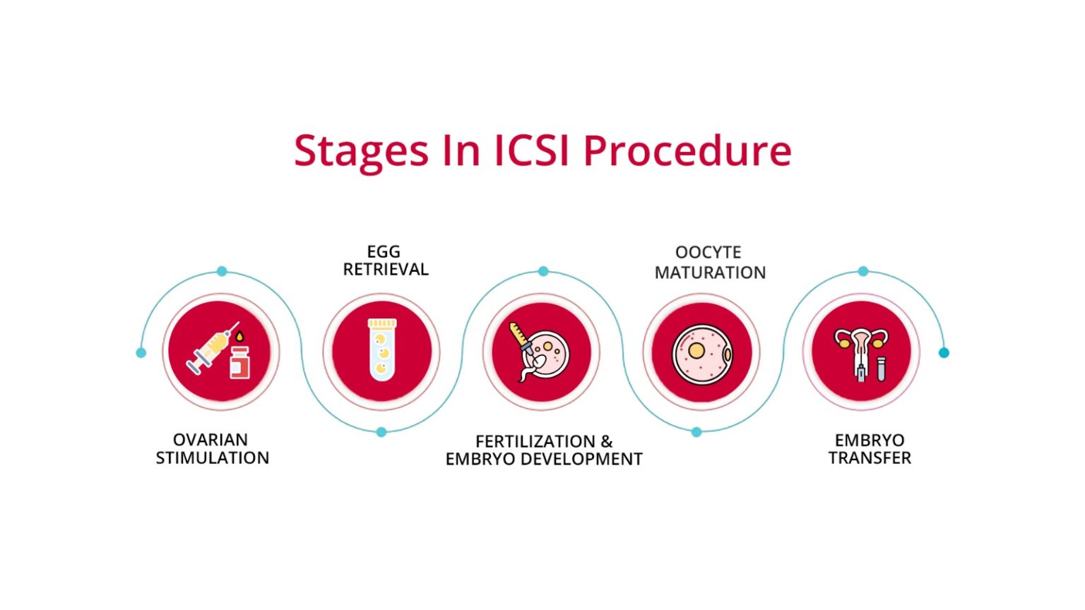 ICSI Procedure Stages