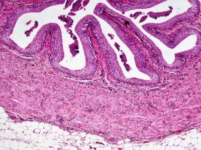 Fetal Tissues image