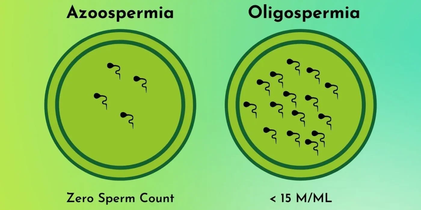 Difference between Azoospermia & Oligospermia | Australian Concept