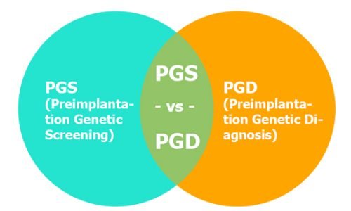 PGS VS PGD